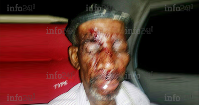 Un trentenaire roue de coups son beau-père à Akanda